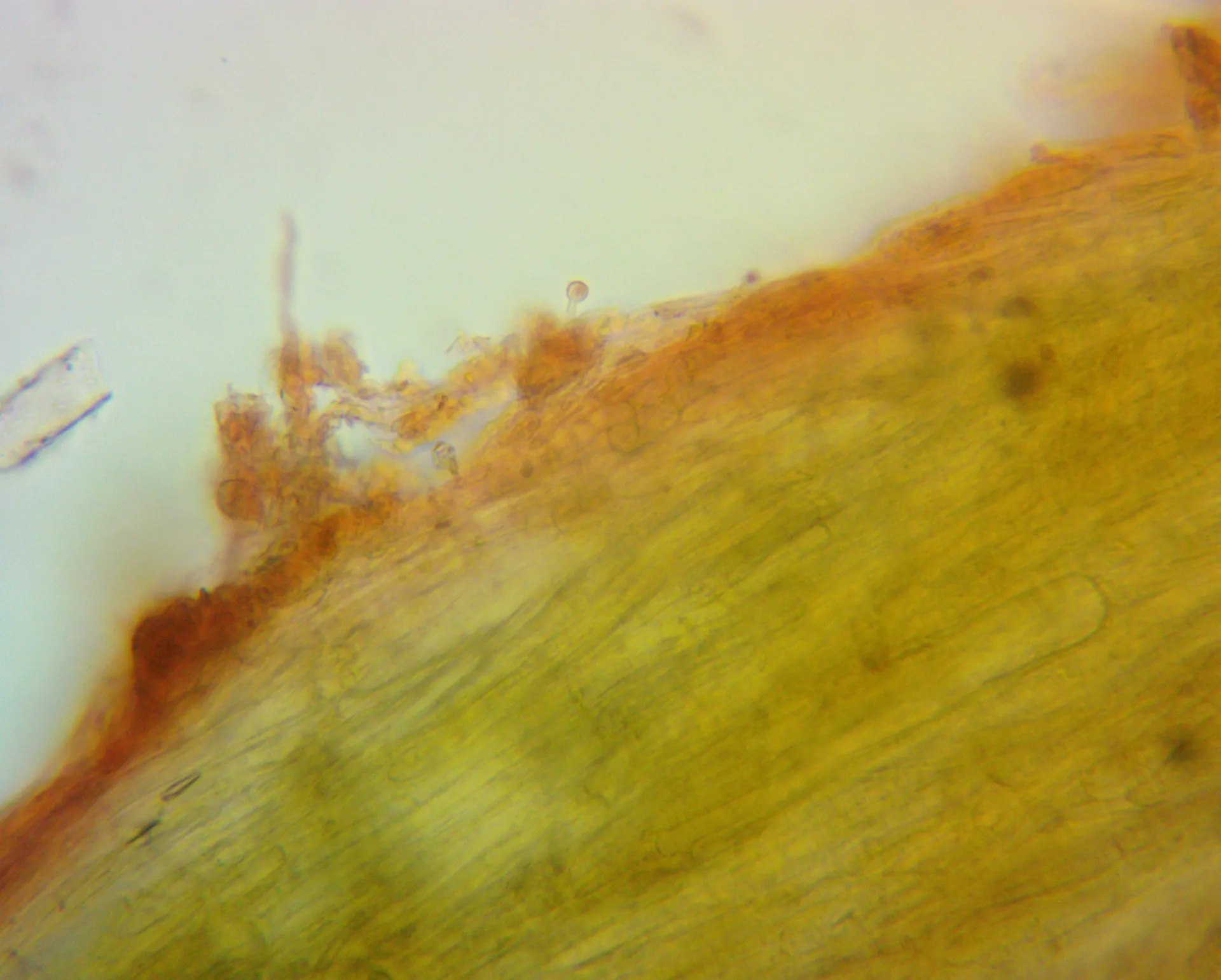 Caulocistidio, 400X